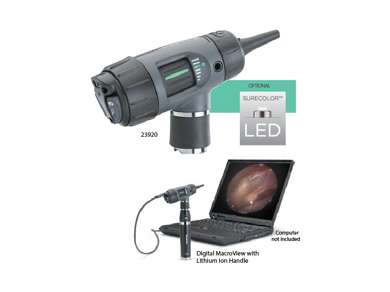 digital_macroview_otoscope